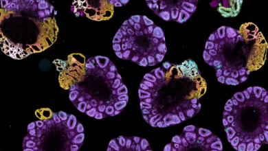 How Tissue-Derived Cell Lines Enhance Disease Modeling