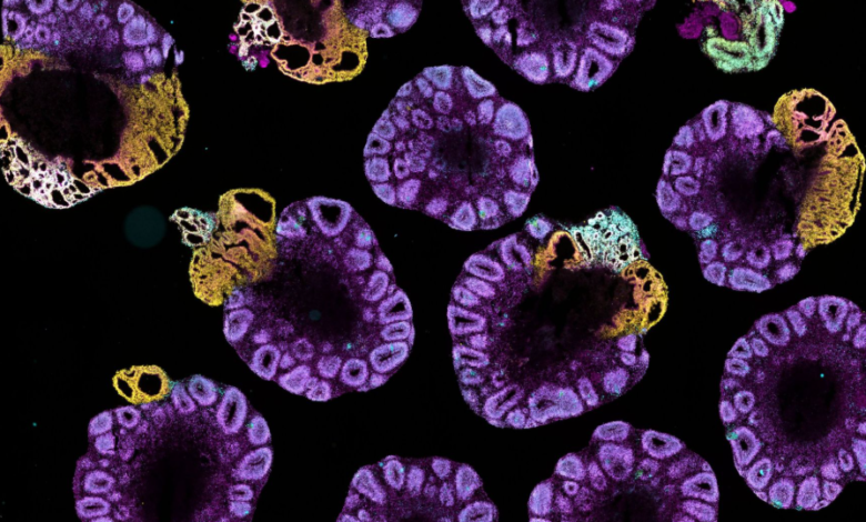 How Tissue-Derived Cell Lines Enhance Disease Modeling