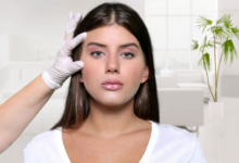 Upper Eyelid Blepharoplasty: The Subtle Surgery That Can Transform Your Look