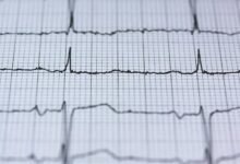 enhance online beacon pulse